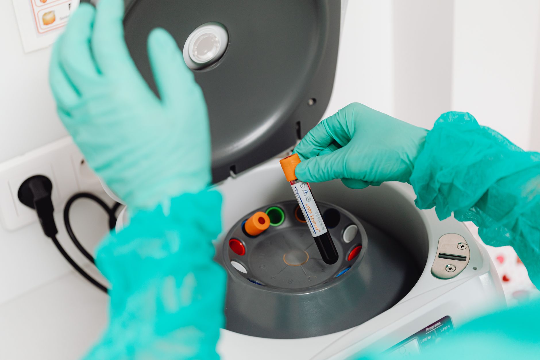 Analyse d'un prélèvement en laboratoire