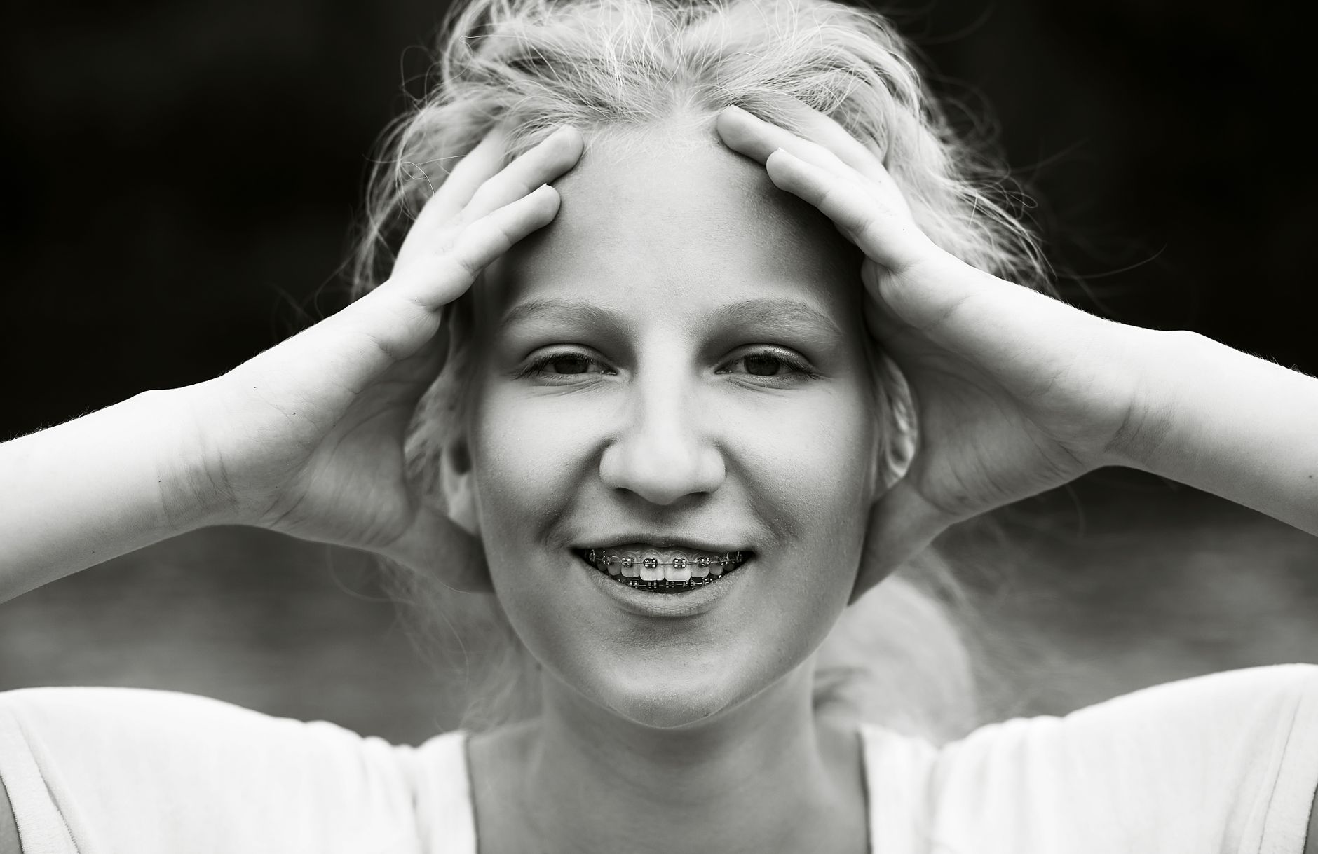 Portrait en noir et blanc d'un sourire avec bagues